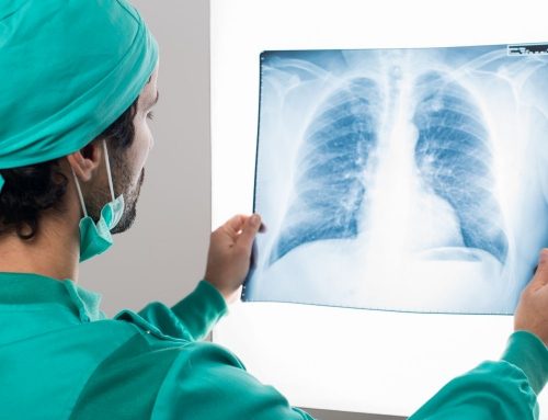Etude LUCSO –  recherche sur le dépistage du cancer du poumon chez les sujets exposés professionnellement.